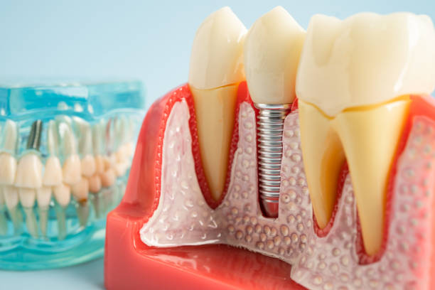 Our Range of Dental Services in Wales, WI